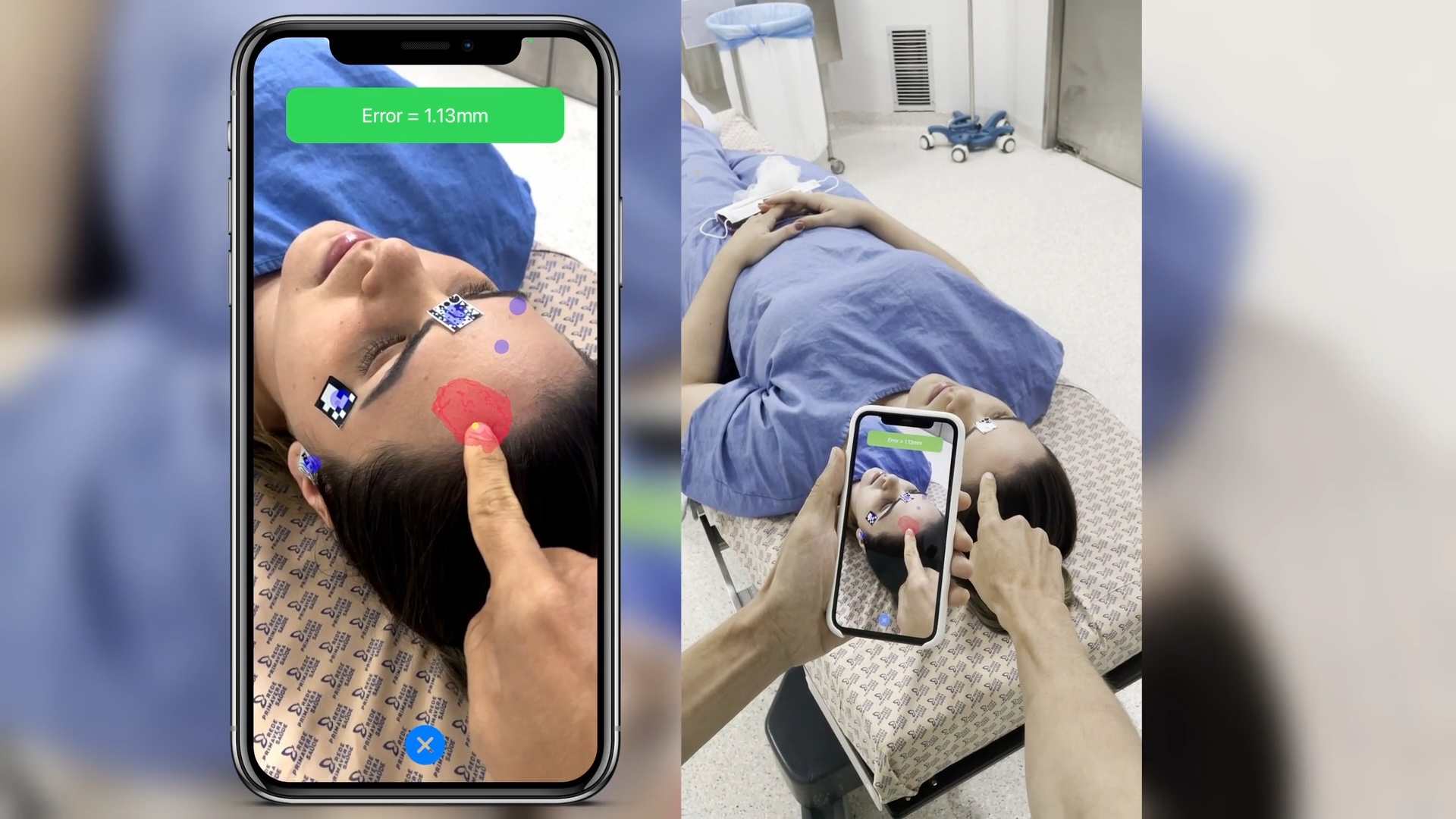 NeuroKeypoint AR